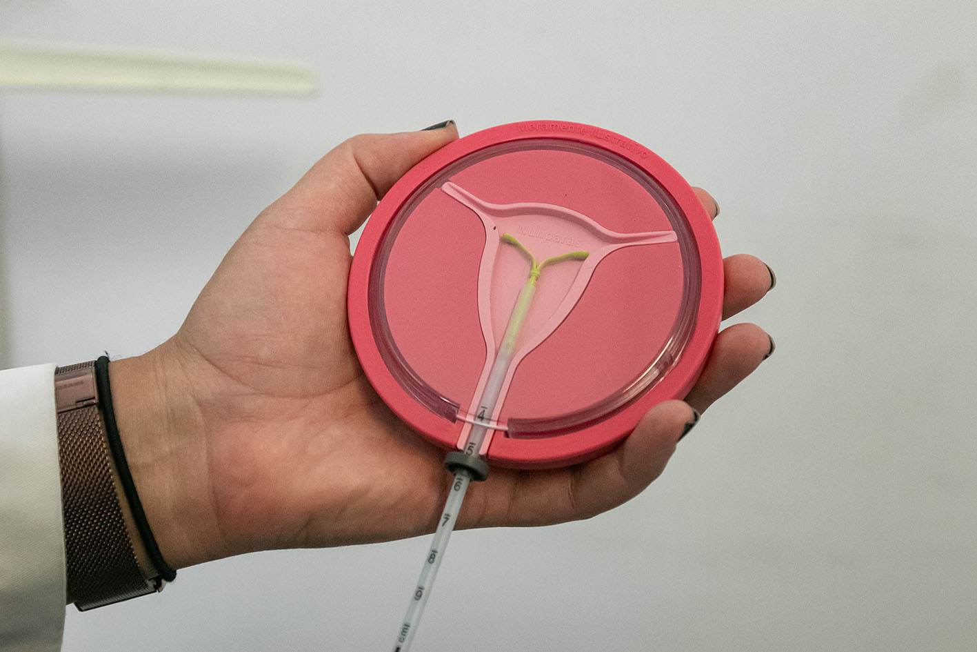 Saúde disponibiliza DIU hormonal para endometriose e outras indicações